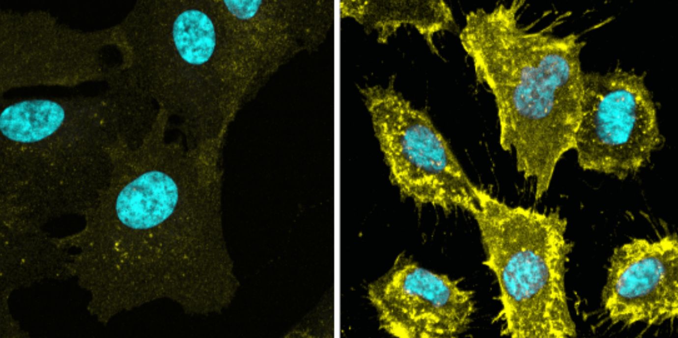 BU: Fluoreszenz Bilder von nicht-cancerogenen diploiden humane Zellen (WT oder TXNIP defizient), die wachsen oder in Quiescenz (Ruhezustand) sind. In Gelb sieht man den Aminosäuretransporter, in Blau die DNA des Zellkerns. © EMBO Journal NEWS_Teis_Quieszenz.jpg