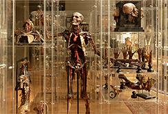 Anatomischen Museum Ibk Exponat