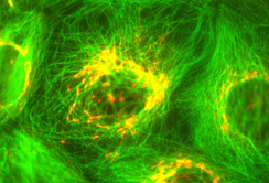Immunfluoreszenzfärbung des Golgi-Komplex (in rot) (Foto: Sektion für Zellbiologie)