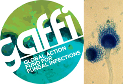 GAFFI („Global Action Fund for Fungal Infections“ ruft politische Entscheidungsträger und Gesundheitsbehörden auf, sich der Gefahr durch Pilzinfektionen bewusst zu werden