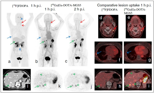 Nuclear Medicine